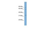 Calpain 11 Antibody in Western Blot (WB)