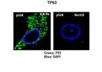 PRPK Antibody in Immunocytochemistry (ICC/IF)