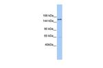 PLEKHH2 Antibody in Western Blot (WB)