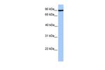 ADAM2 Antibody in Western Blot (WB)