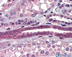 SSX2IP Antibody in Immunohistochemistry (IHC)