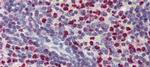 FCHO1 Antibody in Immunohistochemistry (IHC)