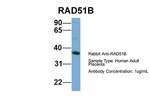 RAD51B Antibody in Western Blot (WB)