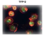 TFPI2 Antibody in Immunocytochemistry (ICC/IF)