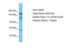 KIAA1462 Antibody in Western Blot (WB)