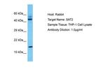 SAT2 Antibody in Western Blot (WB)