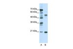 CHRNB3 Antibody in Western Blot (WB)