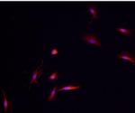 TREM2 Antibody in Immunocytochemistry (ICC/IF)