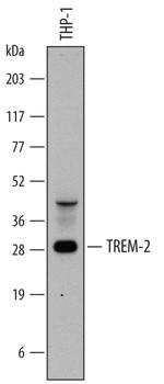 TREM2 Antibody in Western Blot (WB)