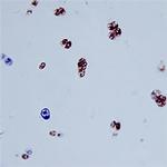 CHI3L1 Antibody in Immunohistochemistry (Paraffin) (IHC (P))