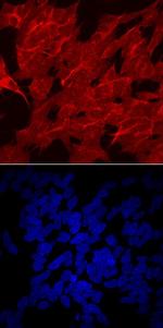 LPL Antibody in Immunocytochemistry (ICC/IF)