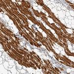 LPL Antibody in Immunohistochemistry (Paraffin) (IHC (P))