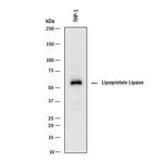 LPL Antibody in Western Blot (WB)