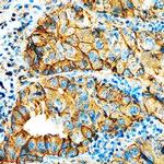 HAI-1 Antibody in Immunohistochemistry (Paraffin) (IHC (P))