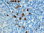 S100A12 Antibody in Immunohistochemistry (Paraffin) (IHC (P))