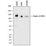 CD51 Antibody in Western Blot (WB)