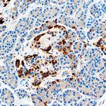 IGFBP7 Antibody in Immunohistochemistry (Paraffin) (IHC (P))