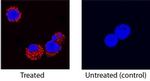 GM-CSF Antibody