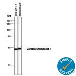 Carbonic Anhydrase I Antibody in Western Blot (WB)