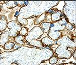 CD200 Antibody in Immunohistochemistry (Paraffin) (IHC (P))