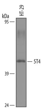 5T4 Antibody in Western Blot (WB)