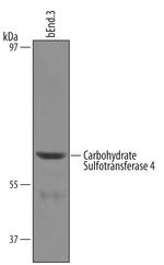 CHST4 Antibody in Western Blot (WB)