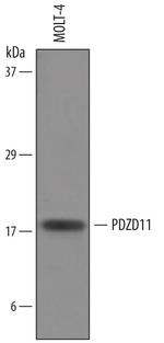 PDZD11 Antibody in Western Blot (WB)