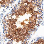 PRSS21 Antibody in Immunohistochemistry (Frozen) (IHC (F))