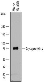 CD42d Antibody in Western Blot (WB)