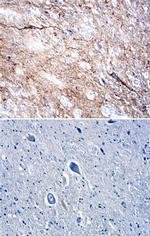 DPP6 Antibody in Immunohistochemistry (Paraffin) (IHC (P))