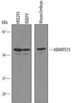 ADAMTS15 Antibody in Western Blot (WB)