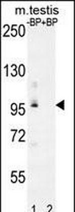 PDPR Antibody in Western Blot (WB)