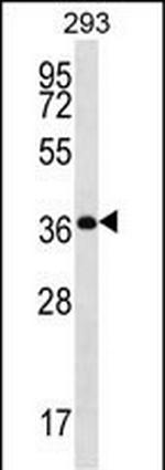 OR10H5 Antibody in Western Blot (WB)