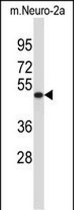 VAT1L Antibody in Western Blot (WB)