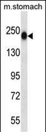 TNN Antibody in Western Blot (WB)