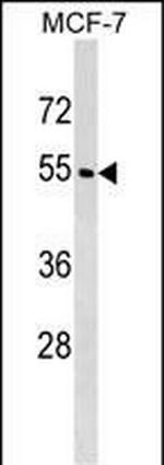 WDR20 Antibody in Western Blot (WB)