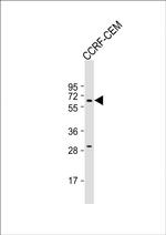 DYTN Antibody in Western Blot (WB)