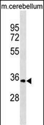 UCK1 Antibody in Western Blot (WB)