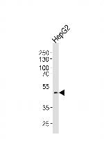 HHCM Antibody in Western Blot (WB)