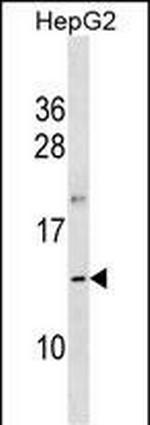 OOSP1 Antibody in Western Blot (WB)