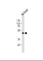 SHB Antibody in Western Blot (WB)