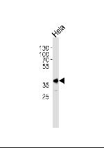 PBK Antibody in Western Blot (WB)