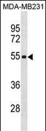 ZSCAN5C Antibody in Western Blot (WB)