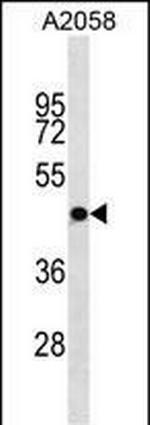 OR4S1 Antibody in Western Blot (WB)