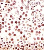 CTR9 Antibody in Immunohistochemistry (Paraffin) (IHC (P))