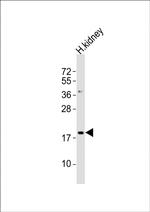 NFE4 Antibody in Western Blot (WB)