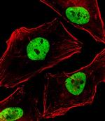 BCL9 Antibody in Immunocytochemistry (ICC/IF)