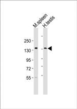 BCL9 Antibody in Western Blot (WB)