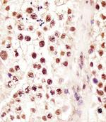 RBMX Antibody in Immunohistochemistry (Paraffin) (IHC (P))