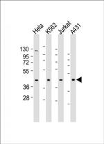 RBMX Antibody in Western Blot (WB)